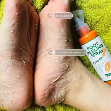 عرض 3 من بخاخ العناية بالقدم - 100 مل - الصورة 4