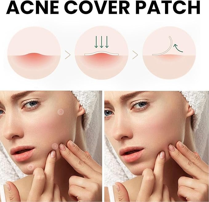 Acne Cover Patch (72pc) - الصورة 4