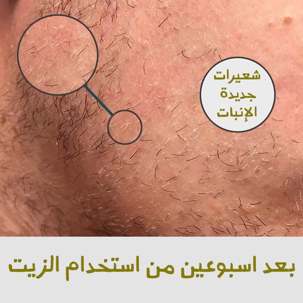 زيت تحفيز بصيلات اللحية - الصورة 4