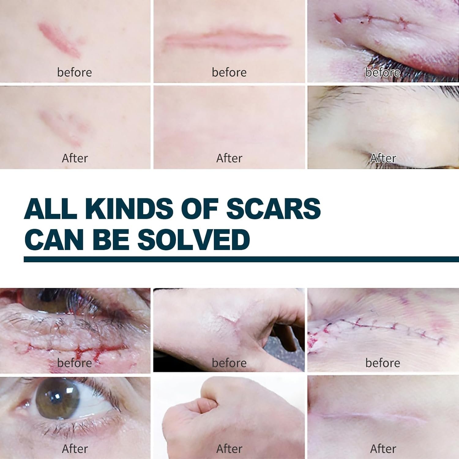 إليهو - جل الندبات المتقدم - الصورة 4