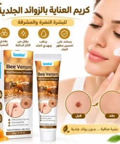 كريم سومي فن لازالة الثأليل و الجلد الزائد - 20 جرام